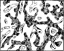 Amyloid Degeneration: figure 1 from the 1928–1936 encyclopedia article