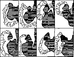 Duodenum: figure 23 from the 1928–1936 encyclopedia article