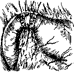 Duodenum: figure 11 from the 1928–1936 encyclopedia article