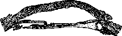 Cataract: figure 8 from the 1928–1936 encyclopedia article