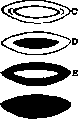 Cataract: figure 1 from the 1928–1936 encyclopedia article