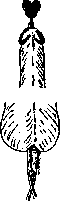 Hypospadias: figure 15 from the 1928–1936 encyclopedia article