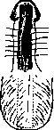 Hypospadias: figure 11 from the 1928–1936 encyclopedia article