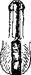 Hypospadias: figure 12 from the 1928–1936 encyclopedia article