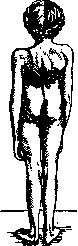 Thorax: figure 8 from the 1928–1936 encyclopedia article
