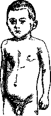 Thorax: figure 6 from the 1928–1936 encyclopedia article