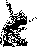 Gilliam-Doleri Operation: figure 1 from the 1928–1936 encyclopedia article