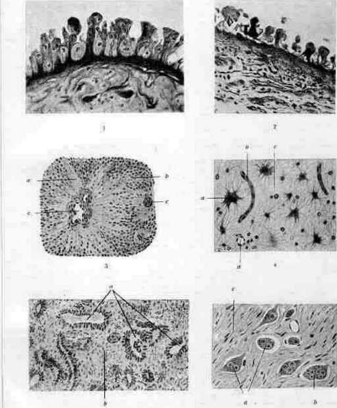 Ganglioneuroma: figure 1 from the 1928–1936 encyclopedia article
