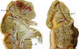 Epiglottis: figure 3 from the 1928–1936 encyclopedia article