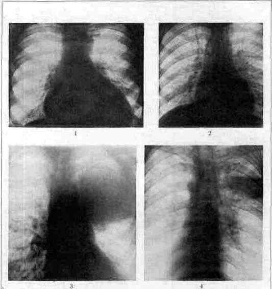 Karl Ernst von Baer: figure 1 from the 1928–1936 encyclopedia article