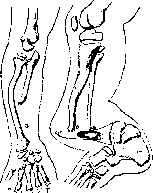 False Joint: figure 3 from the 1928–1936 encyclopedia article