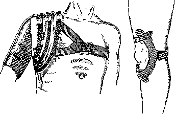 Orthopedic Appliances: figure 10 from the 1928–1936 encyclopedia article