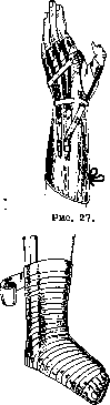 Orthopedic Appliances: figure 22 from the 1928–1936 encyclopedia article