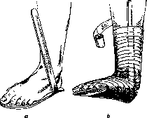 Orthopedic Appliances: figure 20 from the 1928–1936 encyclopedia article