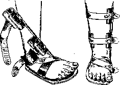 Orthopedic Appliances: figure 18 from the 1928–1936 encyclopedia article
