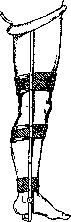 Orthopedic Appliances: figure 11 from the 1928–1936 encyclopedia article