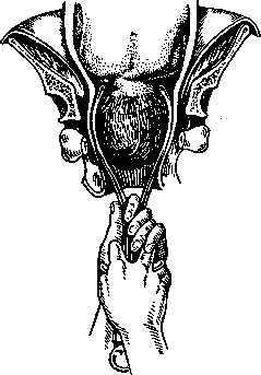 Obstetric Forceps: figure 1 from the 1928–1936 encyclopedia article