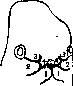 Cleft Palate: figure 1 from the 1928–1936 encyclopedia article