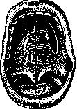 Cleft Palate: figure 4 from the 1928–1936 encyclopedia article