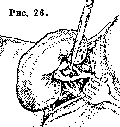 Kidneys: figure 32 from the 1928–1936 encyclopedia article