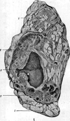 Kidneys: figure 29 from the 1928–1936 encyclopedia article