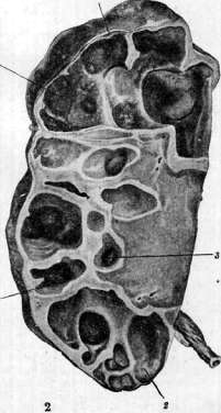 Kidneys: figure 30 from the 1928–1936 encyclopedia article