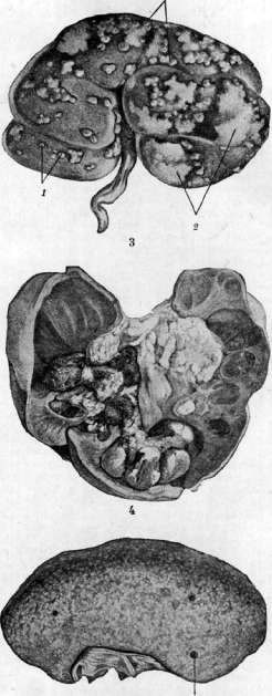 Kidneys: figure 31 from the 1928–1936 encyclopedia article