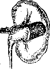 Kidneys: figure 34 from the 1928–1936 encyclopedia article
