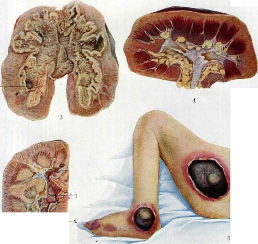 Kidneys: figure 24 from the 1928–1936 encyclopedia article
