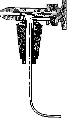 General Anesthesia: figure 2 from the 1928–1936 encyclopedia article