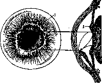 Leukoma: figure 1 from the 1928–1936 encyclopedia article