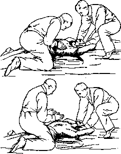 Artificial Respiration: figure 3 from the 1928–1936 encyclopedia article