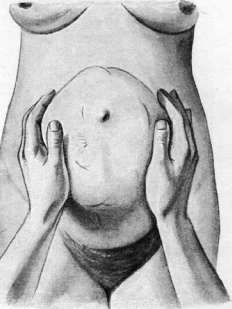 Obstetric Manual Maneuvers: figure 4 from the 1928–1936 encyclopedia article