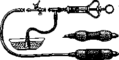 Cardiospasm: figure 1 from the 1928–1936 encyclopedia article