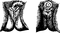Castration: figure 3 from the 1928–1936 encyclopedia article