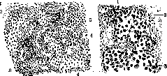 Periosteum: figure 2 from the 1928–1936 encyclopedia article