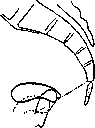 Uterine Prolapse: figure 7 from the 1928–1936 encyclopedia article