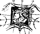 Pelveoperitonitis: figure 4 from the 1928–1936 encyclopedia article