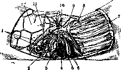 Pelveoperitonitis: figure 3 from the 1928–1936 encyclopedia article