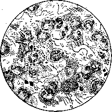 Vagina: figure 3 from the 1928–1936 encyclopedia article