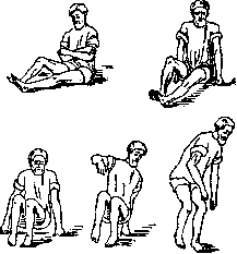 Sciatica: figure 3 from the 1928–1936 encyclopedia article