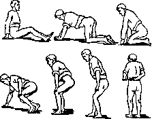 Sciatica: figure 4 from the 1928–1936 encyclopedia article