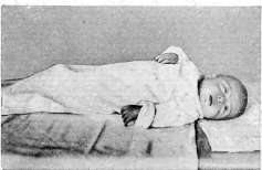 Infant: figure 9 from the 1928–1936 encyclopedia article