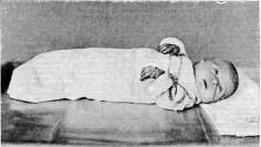 Infant: figure 8 from the 1928–1936 encyclopedia article