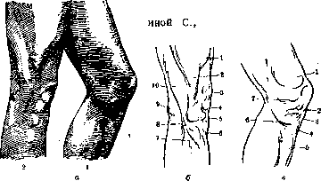 Joints: figure 30 from the 1928–1936 encyclopedia article