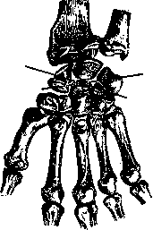 Joints: figure 7 from the 1928–1936 encyclopedia article
