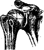 Joints: figure 5 from the 1928–1936 encyclopedia article