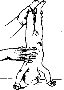 Aspheric Lenses: figure 4 from the 1928–1936 encyclopedia article