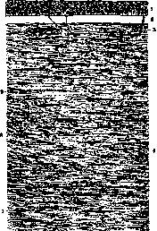 Cornea: figure 1 from the 1928–1936 encyclopedia article