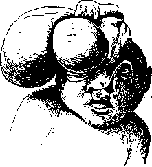 Amniotic Threads: figure 1 from the 1928–1936 encyclopedia article